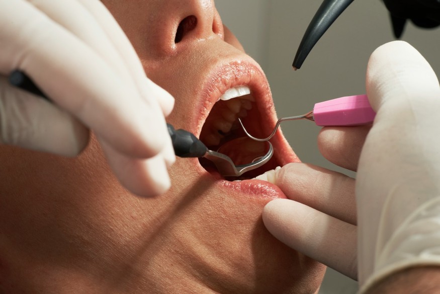 Rise in dental fees confirmed by Welsh Government slammed